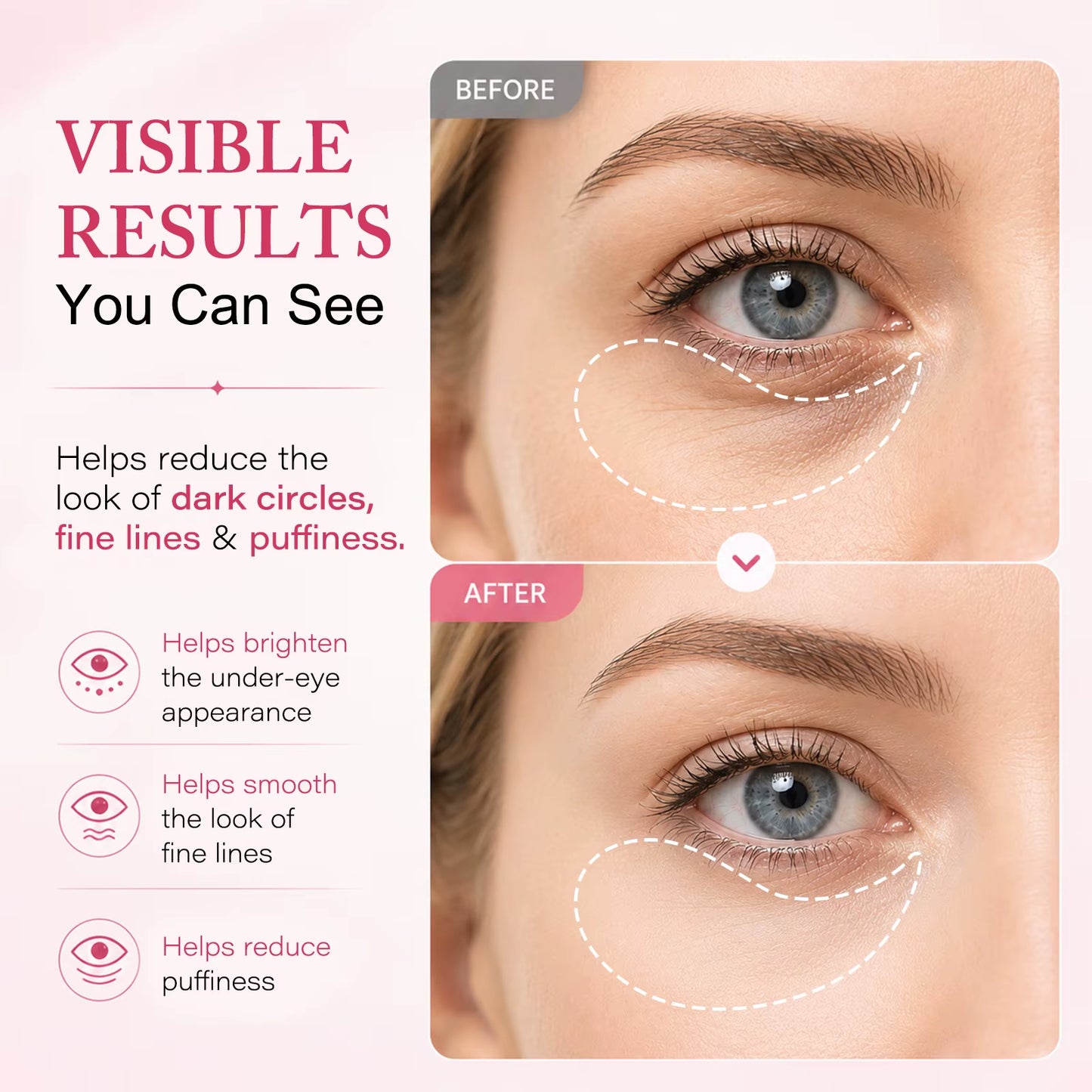 Masaigge Collagen Hydrating Gel Pads Collagen Peptide Eye Patches with Collagen Water 15 Peptide Complex Niacinamide Caffeine